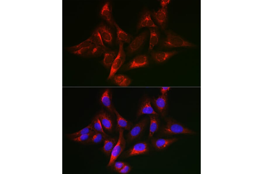 Immunofluorescence - Anti-SHC Antibody (A16912) - Antibodies.com