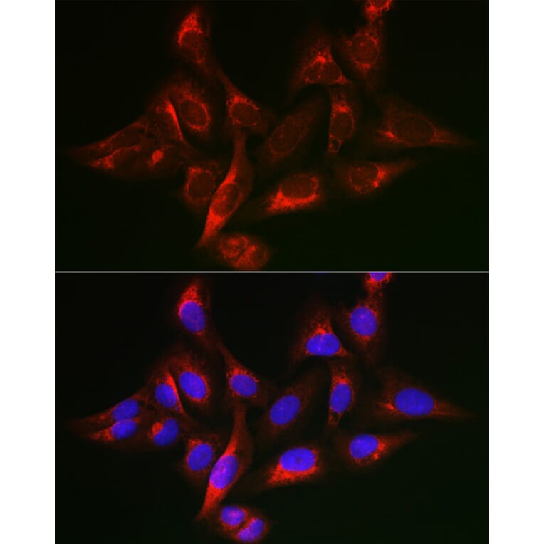 Immunofluorescence - Anti-SHC Antibody (A16912) - Antibodies.com
