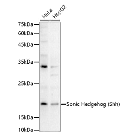 Western Blot - Anti-Sonic Hedgehog Antibody (A16913) - Antibodies.com