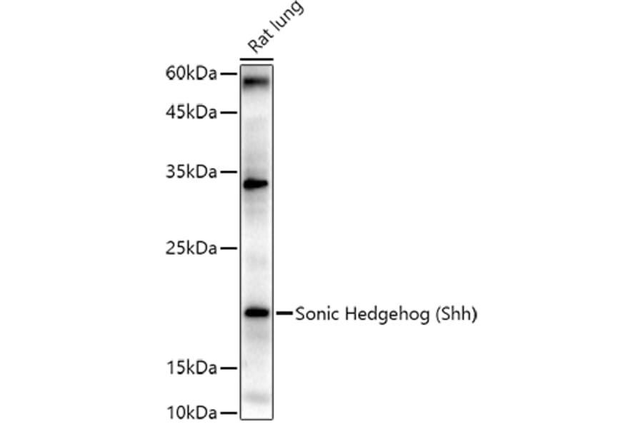 Anti-Sonic Hedgehog Antibody (A16913) | Antibodies.com