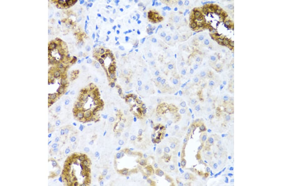 Immunohistochemistry - Anti-Sonic Hedgehog Antibody (A16913) - Antibodies.com
