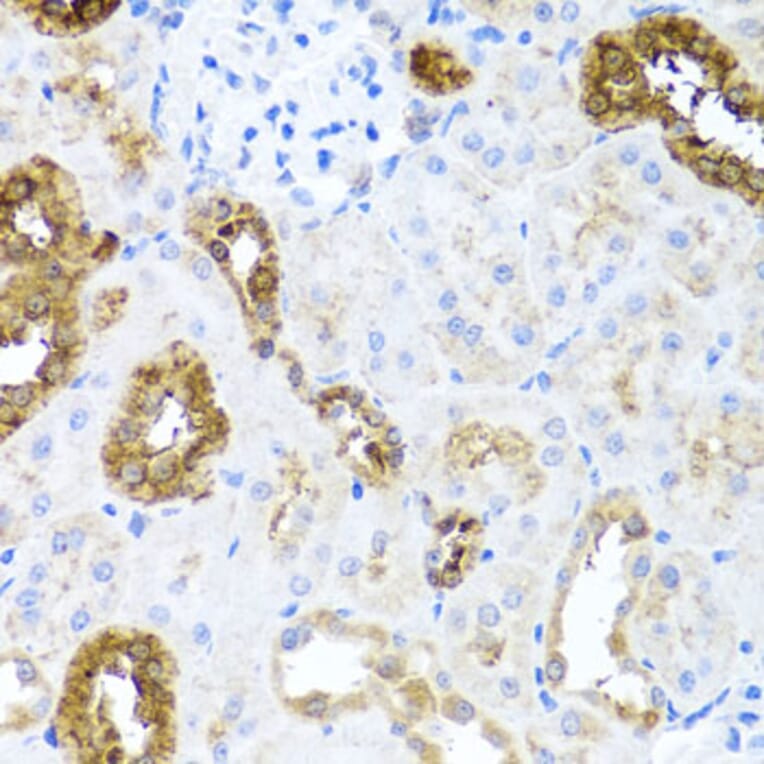 Immunohistochemistry - Anti-Sonic Hedgehog Antibody (A16913) - Antibodies.com