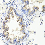 Immunohistochemistry - Anti-Sonic Hedgehog Antibody (A16913) - Antibodies.com