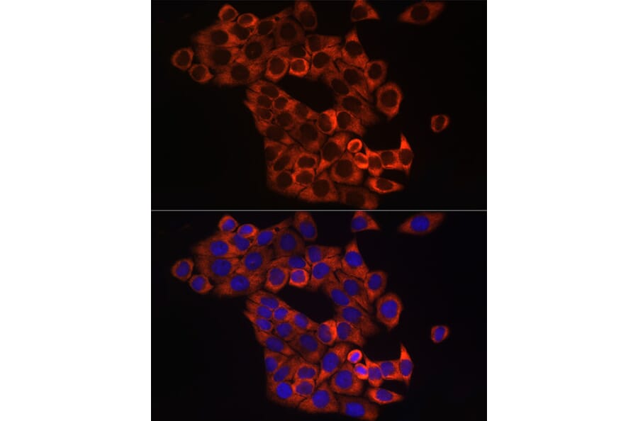 Anti-Sonic Hedgehog Antibody (A16913) | Antibodies.com