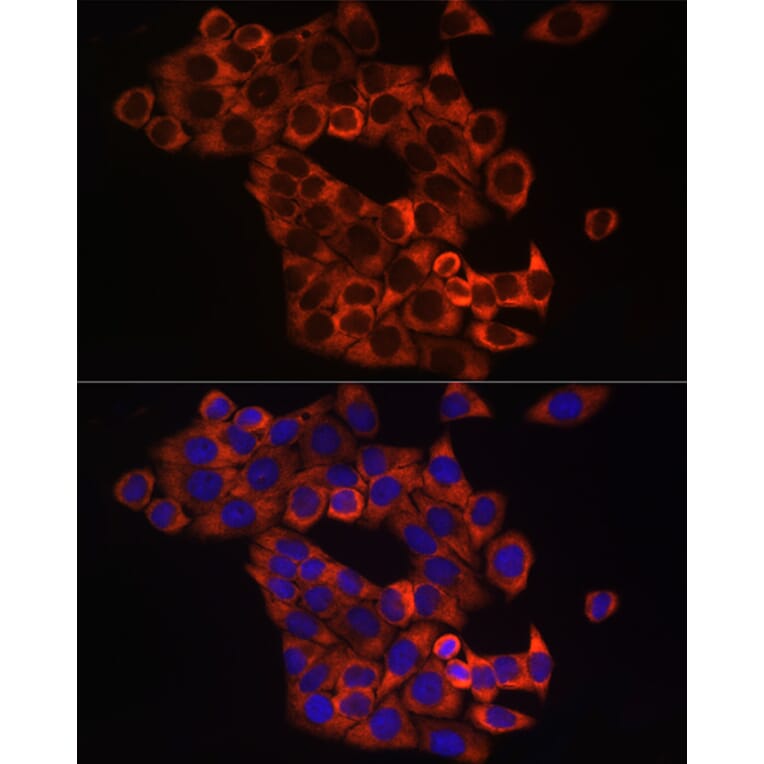 Immunofluorescence - Anti-Sonic Hedgehog Antibody (A16913) - Antibodies.com