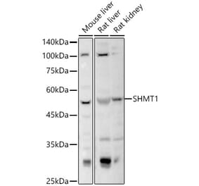 Western Blot - Anti-SHMT1 Antibody (A16914) - Antibodies.com