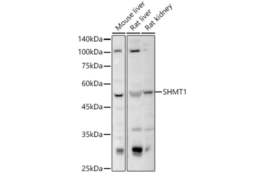 Western Blot - Anti-SHMT1 Antibody (A16914) - Antibodies.com