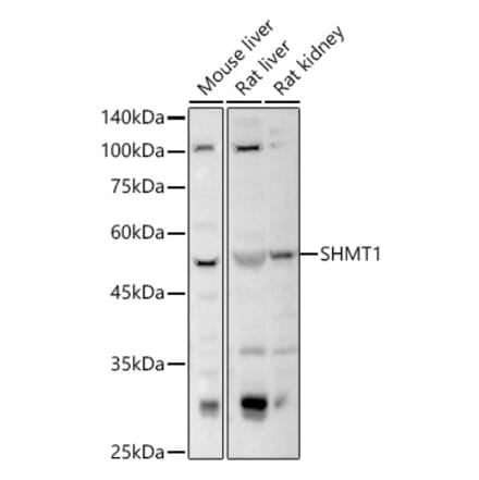 Western Blot - Anti-SHMT1 Antibody (A16914) - Antibodies.com