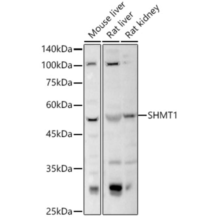 Western Blot - Anti-SHMT1 Antibody (A16914) - Antibodies.com