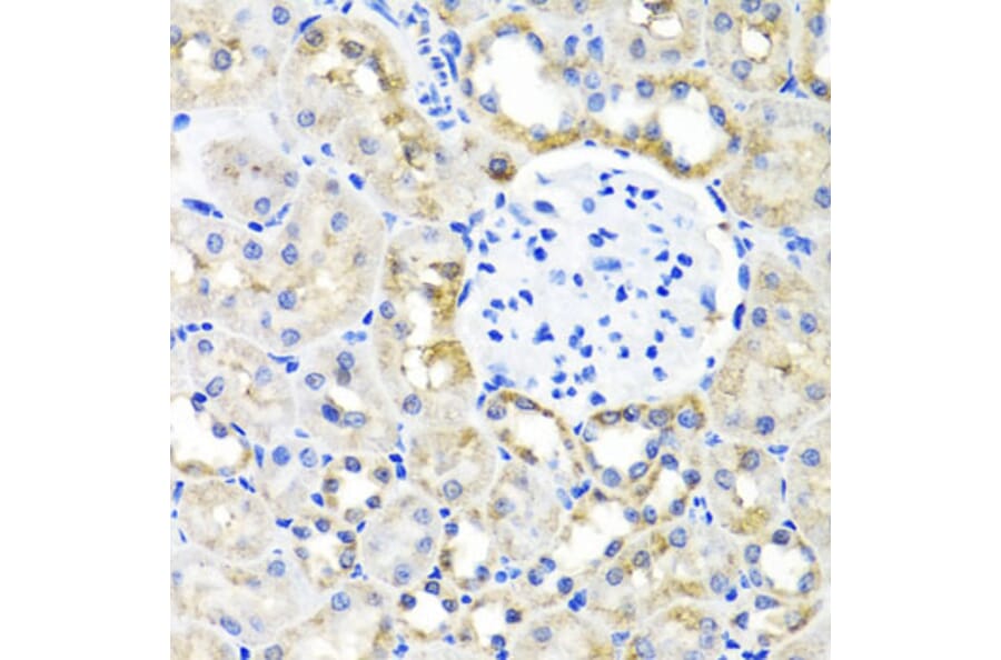 Immunohistochemistry - Anti-SHMT1 Antibody (A16914) - Antibodies.com