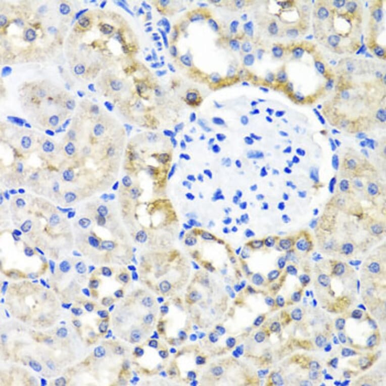 Immunohistochemistry - Anti-SHMT1 Antibody (A16914) - Antibodies.com