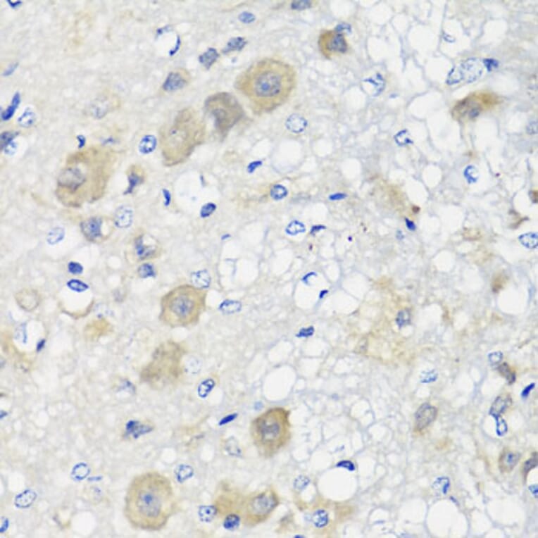 Immunohistochemistry - Anti-SHMT1 Antibody (A16914) - Antibodies.com