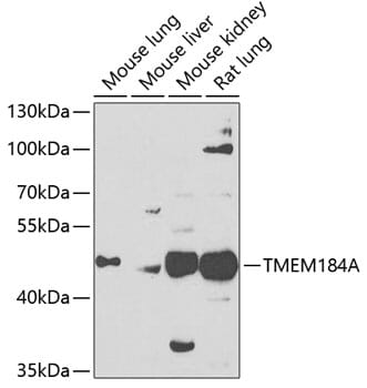 Western blot analysis of extracts of various cell lines, using Anti-TMEM184A Antibody (A7857) at 1:1,000 dilution. Secondary antibody: Goat Anti-Rabbit IgG (H+L) (HRP) (AS014) at 1:10,000 dilution. Lysates / proteins: 25µg per lane. Blocking buffer: 3% non-fat dry milk in TBST. Detection: ECL Enhanced Kit (RM00021). Exposure time: 90s.