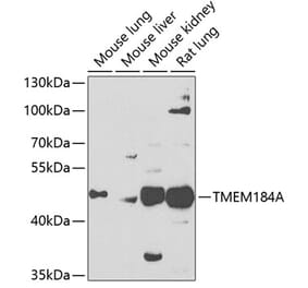 Western Blot - Anti-TMEM184A Antibody (A16915) - Antibodies.com