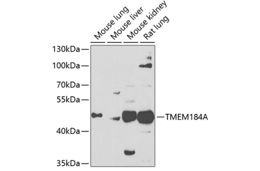 Western Blot - Anti-TMEM184A Antibody (A16915) - Antibodies.com