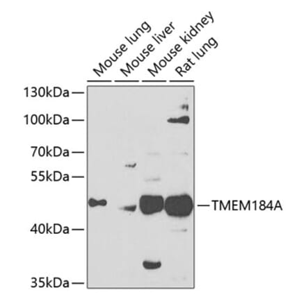 Western Blot - Anti-TMEM184A Antibody (A16915) - Antibodies.com