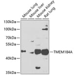 Western Blot - Anti-TMEM184A Antibody (A16915) - Antibodies.com