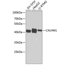 Western Blot - Anti-CALHM1 Antibody (A16916) - Antibodies.com