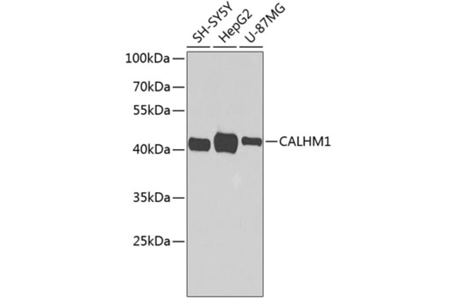 Western Blot - Anti-CALHM1 Antibody (A16916) - Antibodies.com
