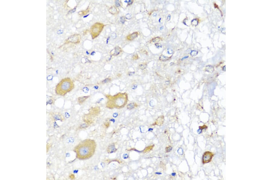 Immunohistochemistry - Anti-CALHM1 Antibody (A16916) - Antibodies.com