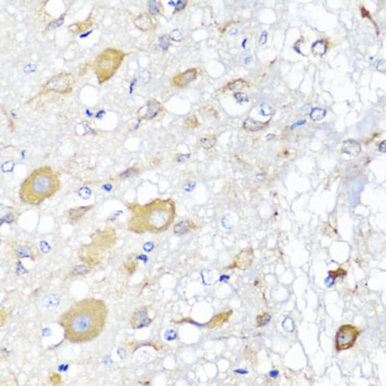 Immunohistochemistry - Anti-CALHM1 Antibody (A16916) - Antibodies.com