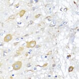 Immunohistochemistry - Anti-CALHM1 Antibody (A16916) - Antibodies.com