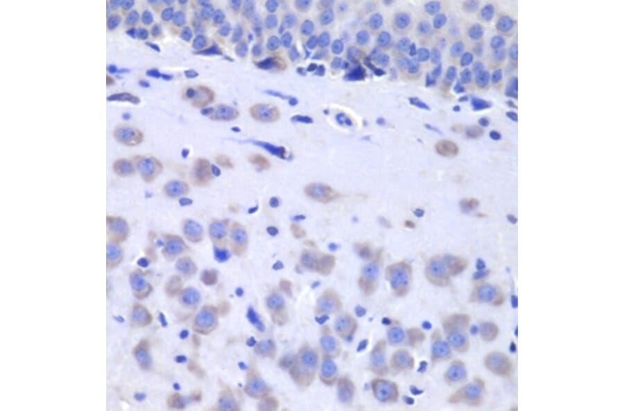 Immunohistochemistry - Anti-HTT Antibody (A7900) - Antibodies.com