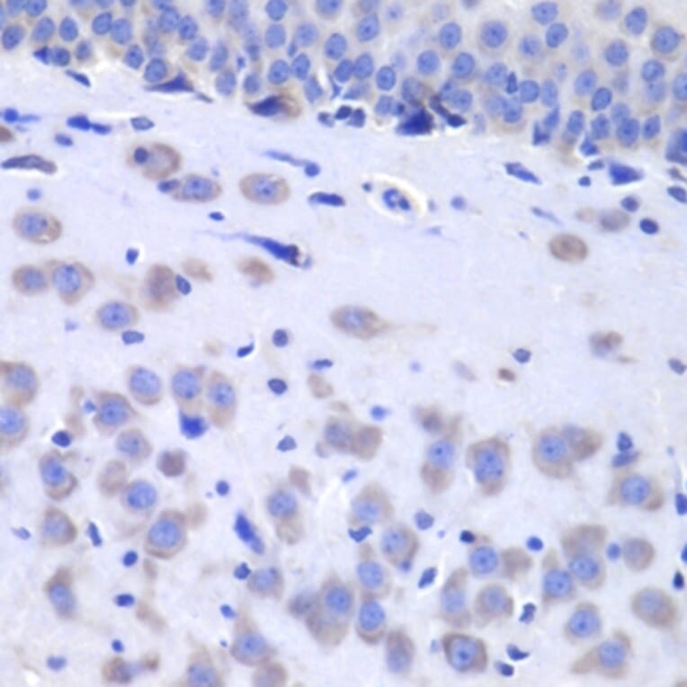 Immunohistochemistry - Anti-HTT Antibody (A7900) - Antibodies.com