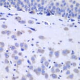 Immunohistochemistry - Anti-HTT Antibody (A7900) - Antibodies.com