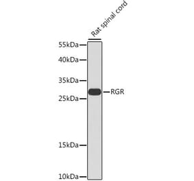 Western Blot - Anti-RGR Antibody (A16919) - Antibodies.com