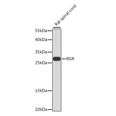 Western Blot - Anti-RGR Antibody (A16919) - Antibodies.com