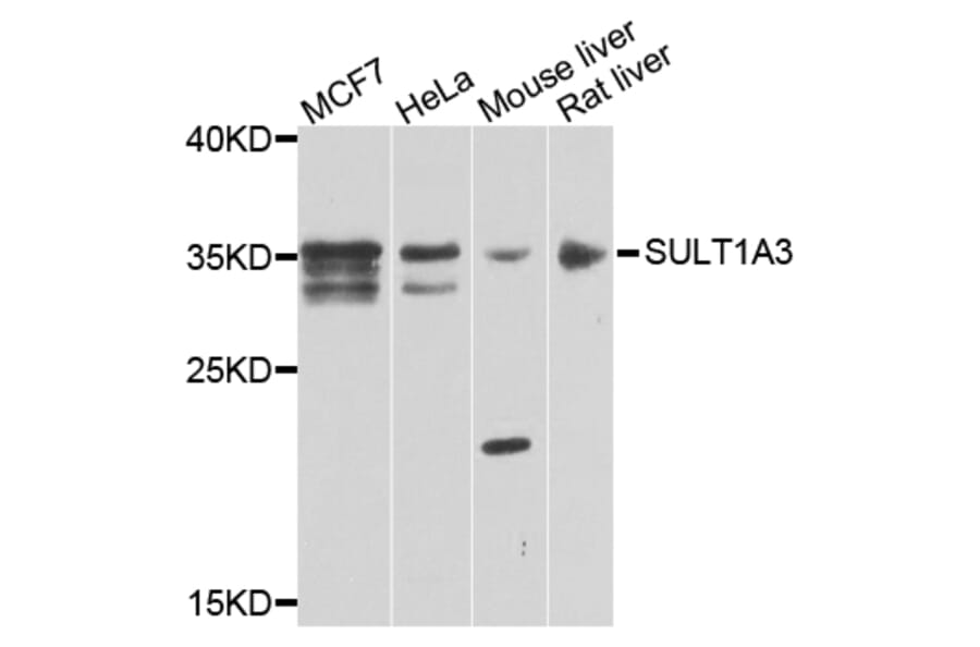 Western Blot - Anti-SULT1A3 Antibody (A7932) - Antibodies.com