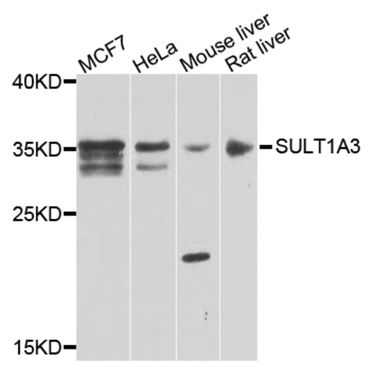 Western Blot - Anti-SULT1A3 Antibody (A7932) - Antibodies.com