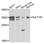 Western Blot - Anti-SULT1A3 Antibody (A7932) - Antibodies.com