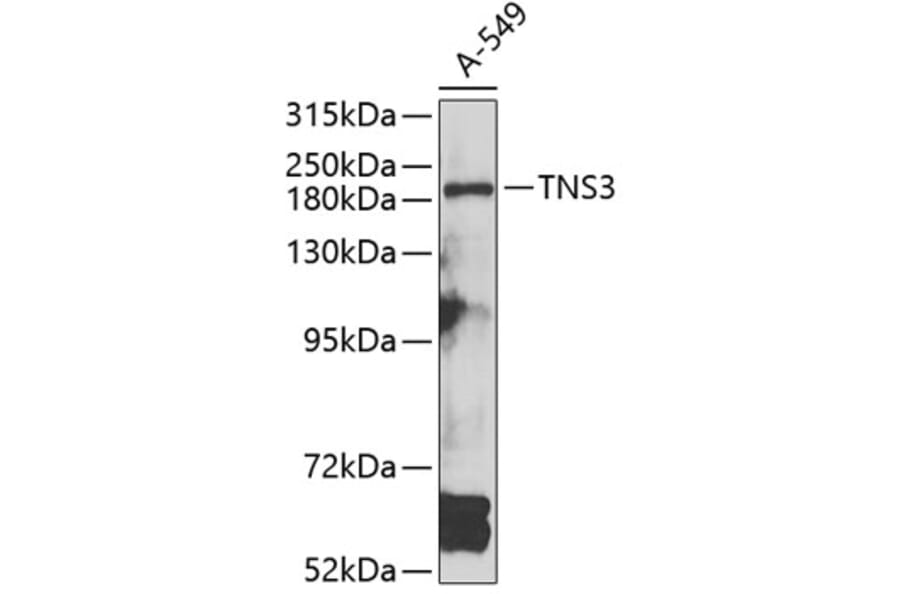 Western Blot - Anti-TNS3 Antibody (A7991) - Antibodies.com