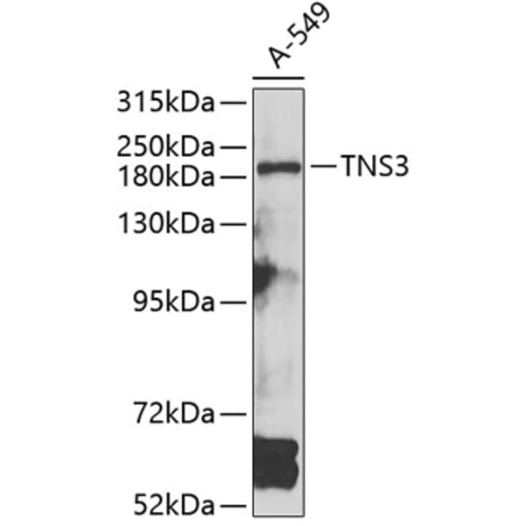 Western Blot - Anti-TNS3 Antibody (A7991) - Antibodies.com