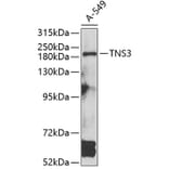 Western Blot - Anti-TNS3 Antibody (A7991) - Antibodies.com