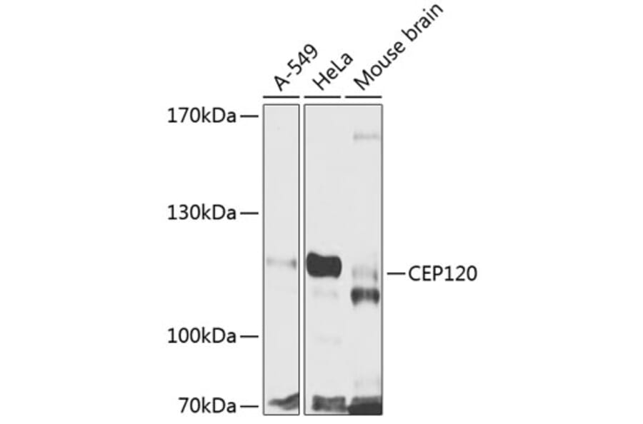 Western Blot - Anti-CEP120 Antibody (A16922) - Antibodies.com