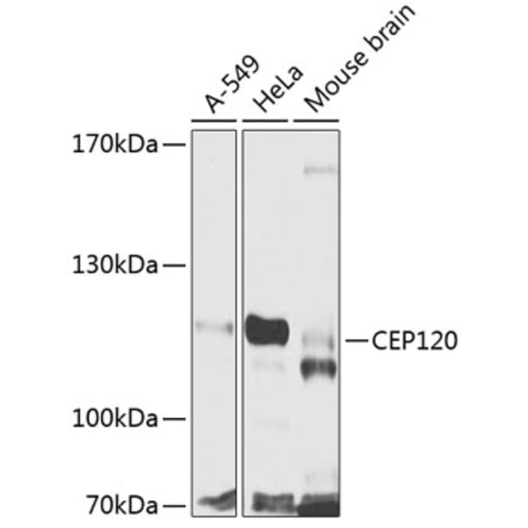 Western Blot - Anti-CEP120 Antibody (A16922) - Antibodies.com