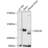 Western Blot - Anti-CEP120 Antibody (A16922) - Antibodies.com
