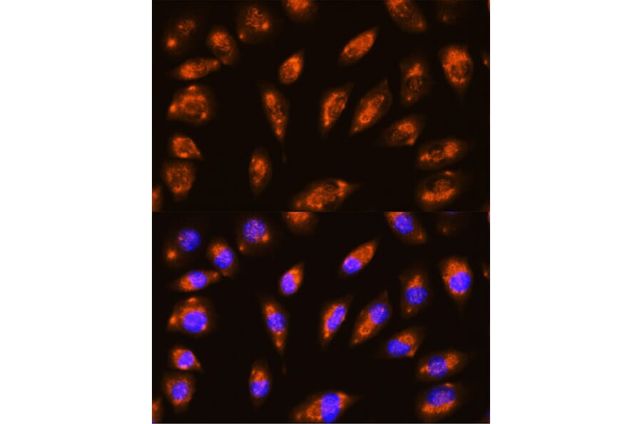 Immunofluorescence - Anti-GRID1 Antibody (A16923) - Antibodies.com
