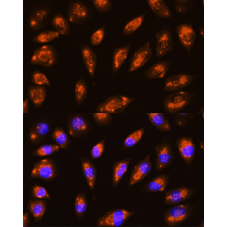 Immunofluorescence - Anti-GRID1 Antibody (A16923) - Antibodies.com