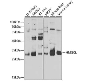 Western Blot - Anti-HMGCL Antibody (A16925) - Antibodies.com
