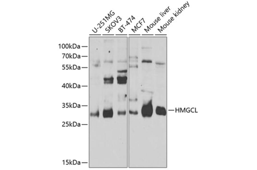 Western Blot - Anti-HMGCL Antibody (A16925) - Antibodies.com