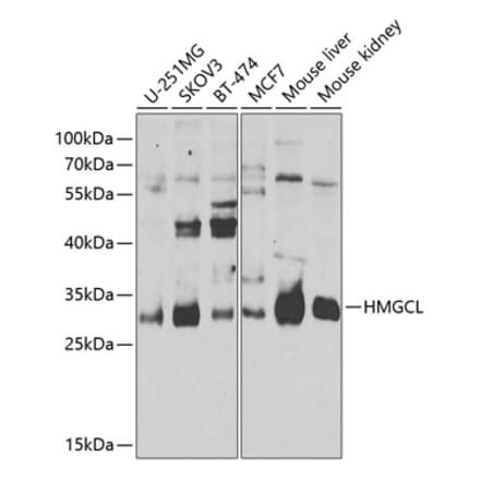 Western Blot - Anti-HMGCL Antibody (A16925) - Antibodies.com