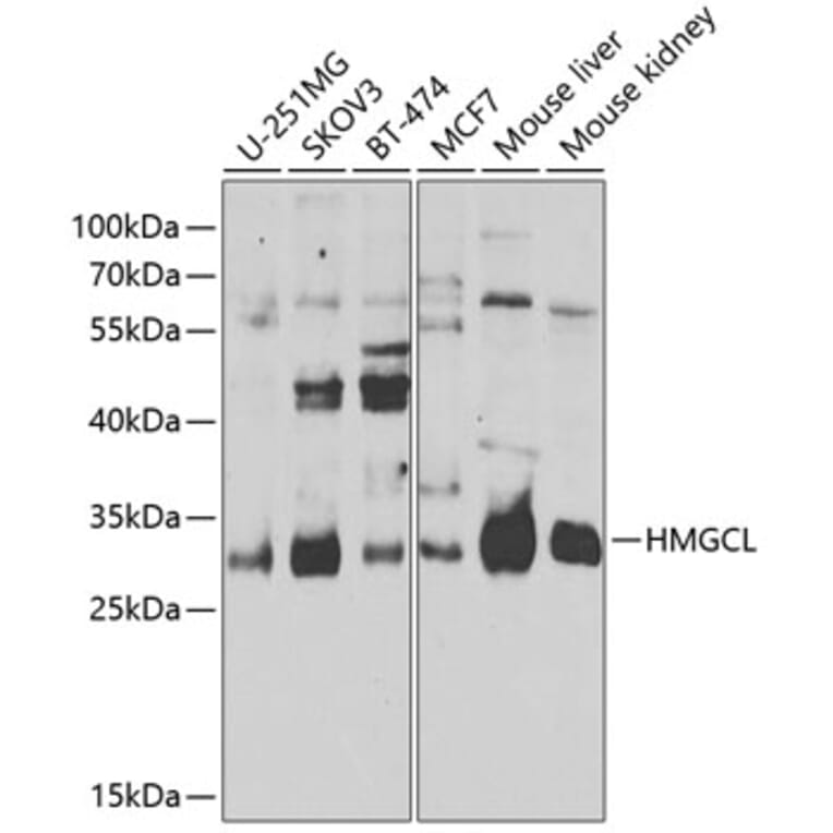 Western Blot - Anti-HMGCL Antibody (A16925) - Antibodies.com