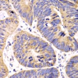 Immunohistochemistry - Anti-HMGCL Antibody (A16925) - Antibodies.com