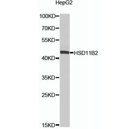 Western Blot - Anti-HSD11B2 Antibody (A16926) - Antibodies.com