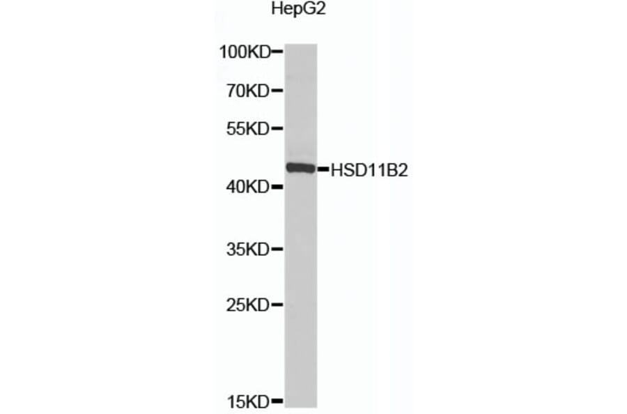 Western Blot - Anti-HSD11B2 Antibody (A16926) - Antibodies.com