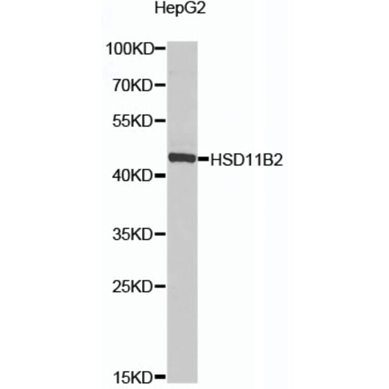 Western Blot - Anti-HSD11B2 Antibody (A16926) - Antibodies.com